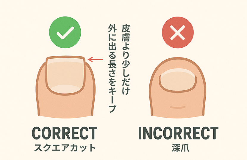 適切な爪切りの長さ